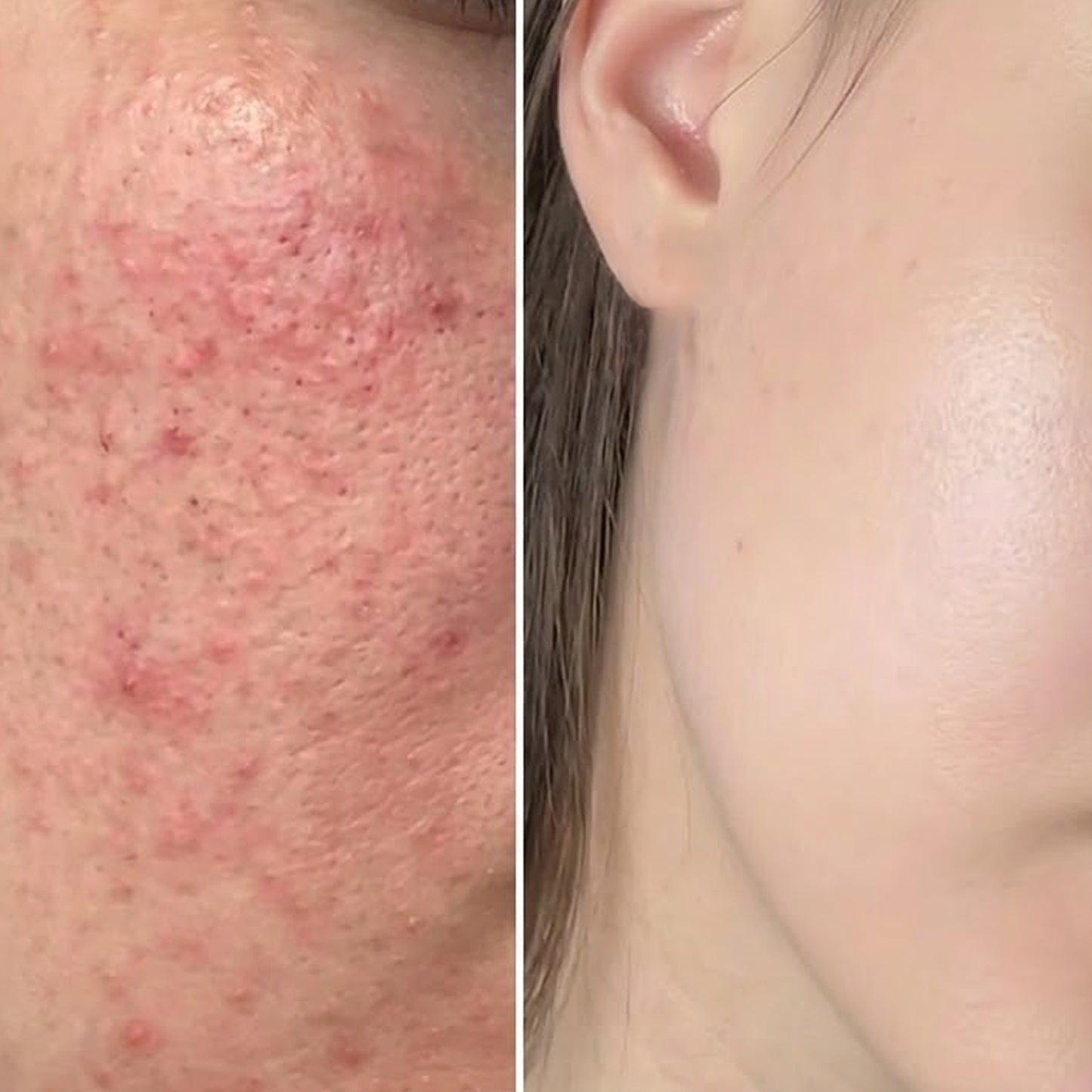 KIARA Niacinamide Serum