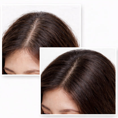 Altressa shampoo